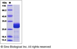 Sino Biological Human TPK1 Protein (His Tag) 50ug, Quantity: Each of 1