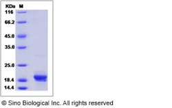 Sino Biological Recombinant Mouse B7-H4 Protein (His Tag), HPLC-verified,