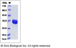 Sino Biological Recombinant Human Annexin A8 Protein (His Tag), Quantity: