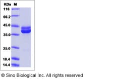 Sino Biological Recombinant Human Mammaglobin B/SCGB2A1 Protein (hFc Tag),