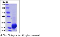 Sino Biological Recombinant Human GMFG Protein (His Tag), Quantity: Each