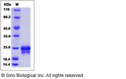 Sino Biological Recombinant Human PFDN5 Protein (His Tag), Quantity: Each