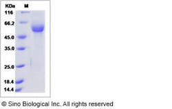 Sino Biological Recombinant Human RAB1B Protein (hFc Tag), Quantity: Each