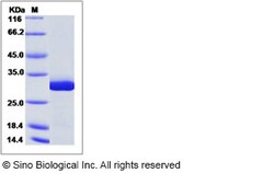 Sino Biological Recombinant Human GSTM5 Protein (His Tag), Quantity: Each