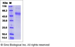 Sino Biological Human FNDC4 / FRCP1 Protein (ECD, Fc Tag) 100ug, Quantity: