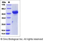Sino Biological Recombinant Human ATL3 Protein (His Tag), Quantity: Each