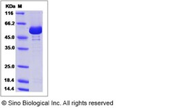 Sino Biological Recombinant Human PKLR Protein (His Tag), Quantity: Each