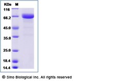 Sino Biological Human LRRC32 Protein (His Tag) 50ug, Quantity: Each of