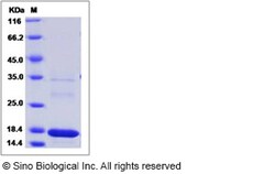Sino Biological Recombinant Human MAGOH Protein (His Tag), Quantity: Each