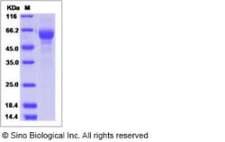 Sino Biological Recombinant Human Somatostatin Receptor 1/SSR1 Protein