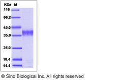 Sino Biological Recombinant Human RBKS Protein (His Tag), Quantity: Each