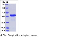 Sino Biological Recombinant Human PIG3 Protein (His Tag), Quantity: Each