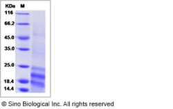 Sino Biological Recombinant Human VMO1 Protein, Quantity: Each of 1