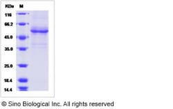 Sino Biological Recombinant Human Amelotin Protein (mFc Tag), Quantity: