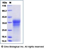 Sino Biological Human INSL6 / RIF1 Protein (His Tag) 100ug, Quantity: Each