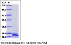 Sino Biological Recombinant Human MUSTN1 Protein (His Tag), Quantity: Each