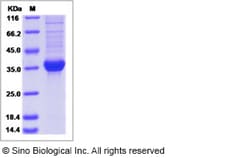 Sino Biological Recombinant Human GHRH Protein (hFc Tag) 100, Quantity: