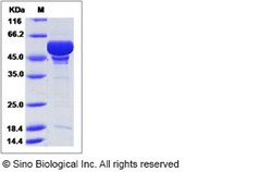 Sino Biological Recombinant Human GABARAP Protein (His & MBP Tag), Quantity: