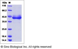 Sino Biological Recombinant Human alpha Lactalbumin/LALBA Protein (mFc