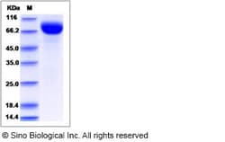 Sino Biological Protein Human BTD 50ug, Quantity: Each of 1
