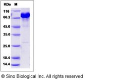 Sino Biological Human NCF-2 / NCF2 / P67phox Protein (His & GST Tag) 50ug,