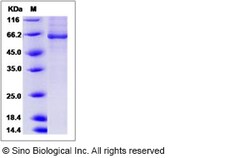 Sino Biological Recombinant Human BBOX1 Protein (His & GST Tag), Quantity: