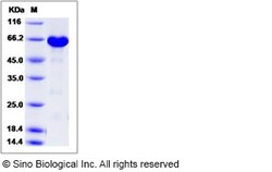 Sino Biological Human ERK3 / MAPK12 / P38-gamma Protein (His & GST Tag)