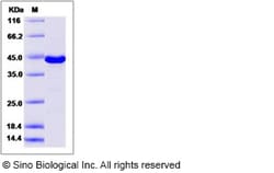 Sino Biological Recombinant Human P38 Gamma/MAPK12 Protein, Quantity: Each