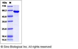 Sino Biological Recombinant Human Sphingosine Kinase 1 Protein (His & GST