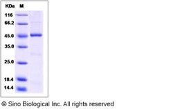 Sino Biological Human SPHK1 / Sphingosine Kinase 1 Protein 50ug, Quantity:
