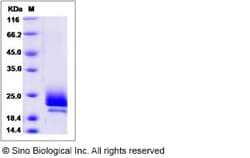Sino Biological Human MZB1 / PERP1 Protein (His Tag) 100ug, Quantity: Each