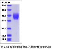 Sino Biological Recombinant Human CADM2 Protein (ECD, His Tag), Quantity: