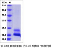 Sino Biological Recombinant Human CDNF Protein (His Tag), Quantity: Each