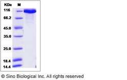 Sino Biological Recombinant Human Neurofascin Protein (His Tag), HPLC-verified,