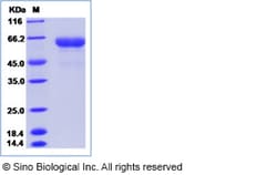 Sino Biological Recombinant Human LRRTM2 Protein (hFc Tag), HPLC-verified,