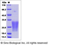 Sino Biological Recombinant Human MUCL1 Protein (His Tag), Quantity: Each
