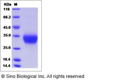 Sino Biological Recombinant Human ULBP6/RAET1L Protein (His Tag) 1, Quantity: