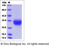 Sino Biological Recombinant Human ULBP6/RAET1L Protein (His Tag), Quantity: