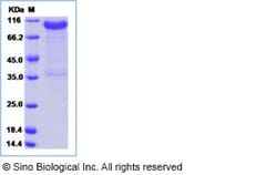 Sino Biological Human LRRC15 Protein (ECD, Fc Tag) 1mg, Quantity: Each