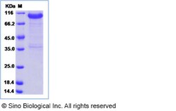 Sino Biological Recombinant Human LRRC15 Protein (ECD, hFc Tag), Quantity: