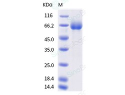 Sino Biological Recombinant Human LRRC15 Protein (ECD, His Tag), HPLC-verified,