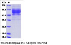 Sino Biological Human CSTL1 / Cystatin-like 1 Protein (Fc Tag) 100ug, Quantity: