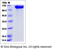 Sino Biological Human PSMA / FOLH1 Protein (His Tag), Biotinylated 100ug,