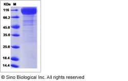 Sino Biological Recombinant Human IL-31RA Protein (His Tag), HPLC-verified