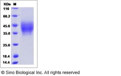Sino Biological Human NPTN / SDFR1 Protein (His Tag, ECD) 100ug, Quantity: