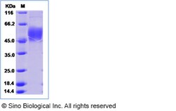 Sino Biological Recombinant Human ATP1B2 Protein (His Tag), Quantity: Each
