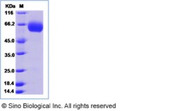 Sino Biological Human TMPRSS11B Protein (His Tag) 100ug, Quantity: Each