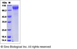 Sino Biological Human GPR133 / PGR25 Protein (ECD, His Tag) 100ug, Quantity: