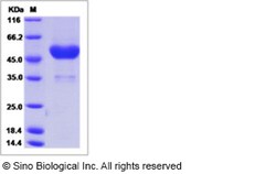Sino Biological Human Frizzled-6 / FZD6 Protein (Fc Tag) 100ug, Quantity: