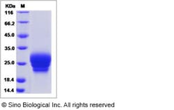 Sino Biological Recombinant Human Frizzled 6 Protein (His Tag) 1, Quantity: